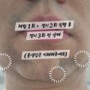 이현한방병원 네이버블로그