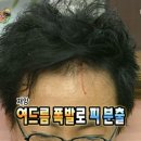 가론 에스테틱 네이버블로그