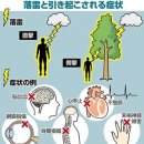 벼락맞으면 몸에 일어나는 증상은？ 년간20명이 사망…나무 밑에서의 비를 피하는 것은 NG ​ 이미지