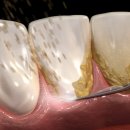 비우고채우는치과의원 이미지