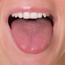 삼산건치과의원 네이버블로그
