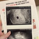 서울마리산부인과의원 네이버블로그
