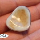 좋은의안 이미지