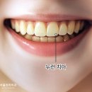 서울의리치과의원 네이버블로그