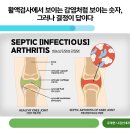 유대현나경선내과의원 | 남부터미널류마티스내과,갑작스러운 무릎 통증, ‘통풍’만 떠올리면 놓치는 것