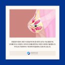 연세순내과의원 네이버블로그