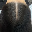 헤드샷스칼프본점 | 헤드샷스칼프 분당본점 자연스러운 두피 정수리 커버 지속력