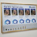 히든독일보청기 이미지