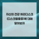 가양메트로정형외과의원 | 자신의 건강 허리디스크 (디스크탈출증)에 대해 알아보자