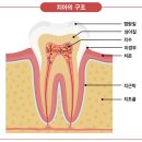 건강 : 시리고 아픈 치아, 원인 모두 달라 이미지