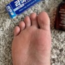 올로크 | 부테나로크 일본 뿌리는 무좀약 경험자의 비교 후기