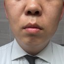 시흥자인한방병원 | 시흥배곧 피부과에서 수면시술 찐후기