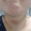 한종배피부과