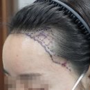 뉴헤어라인 - 순천시 | 뉴헤어라인