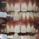 라치과의원 이미지