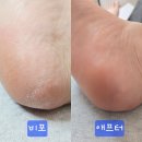 관풍경로당 | 무좀관리 포항무좀발톱 아기 발로 다시 태어나게 해 준 비올라 푸스케어 포항효자점 발각질케어 방문후기