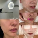 윰 에스테틱 이미지