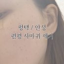 남평택한의원 | 평택 | 평택 용이동 얼굴 편평사마귀 무제한 제거 가성비 끝판왕