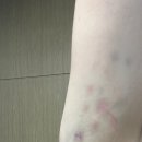 웨딩) 동탄 피부관리 마사지 웨딩케어 추천 : 엘리니아숲