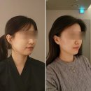 피부관리·경락(수) | 역삼동 피부관리 경락 첫 관리 만족 후기 어메이징빅토리아 강남