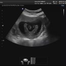 고은빛산부인과의원 이미지