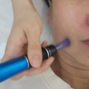 세진메디칼 | 쌍문동 피부관리실 이음메디컬스킨 기미잡티케어 후기 | 파워 기미잡티 관리 받고 왔어요