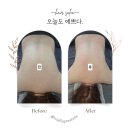 라비에벨뷰티 | 일상_ 붓기, 피로 싹! 다이어트·산전산후 케어 가능한 신중동 라비에벨뷰티 등슬리밍 후기