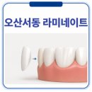 오산서동 라미네이트 후회하는 이유, 하기 전에 꼭 알아야 할 점