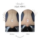 라비에벨뷰티 | 부천 신중동 체형관리 '라비에벨 뷰티' 슬리밍 맛집