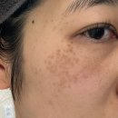 메디센스 이미지