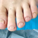 레푸스 앤 쓰담네일 이미지