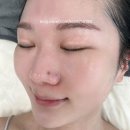 보니따피부관리 이미지