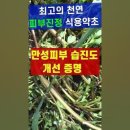 쇠비름: 최고 천연 피부진정제, 피부습진 &amp; 가려움 개선 증명 이미지