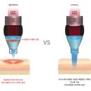 지니어스메디 | 피코케이 데모와 구매 는 메디원큐에서 빠르게 처리하세요~