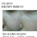 잡티 제거에 탁월한 유황크림 이미지