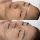 아이렉스 타워 앞 | 용인 처인구피부관리 빛담스킨랩 에서 빼독관리 받고 와서 물광피부 된 후기!