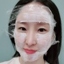 대구 스킨보톡스 3회차 내돈내산 후기｜경대병원역 1번 출구 도보 3분 리메이드의원