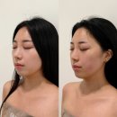 리아아파트 및 상가 | 창원에스테틱 얼굴 3V 윤곽관리 브이라인 잘하는 곳 매끄네에스테틱