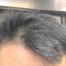 아들은 엄마의 나이를 모른다 | 초등생학생 아들 정수리 냄새에 몽프라키즈샴푸