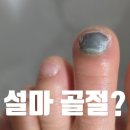안산 정형외과 추천｜발가락 부상으로 방문한 성모본정형외과 후기
