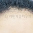 헤어앤리