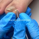 페디베네 이미지