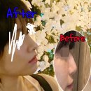 유진성형외과의원 | 자가늑연골코수술, chatGPT가 추천하는 이유👍