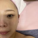 우람농장 | 정왕동 피부샵 구은희에스테틱 :수분보충과 경락관리까지 물광피부완성!!