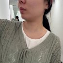 어서멍 | [내돈내산] 명동피부과 인모드 fx 후기 턱라인 시술 효과