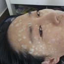 구리올바디한의원 네이버블로그