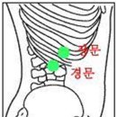 부항 하기 - 급성 사구체 신장염 이미지