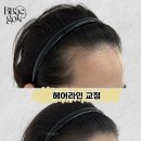 헤어라인 이미지