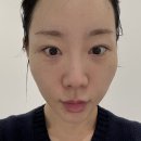 해사람 | 리투오 효과 솔직 후기 (스킨부스터 다 해본 사람의 기준 정리)