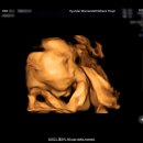 (주)메디웰 | 25주 임신성당뇨 재검사 후기 임산부 혈당관리 방법